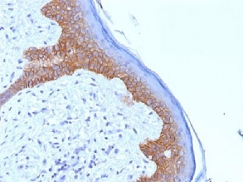 Desmoglein 3 Antibody 5G11 Skin IHC. Immunohistochemistry analysis of Desmoglein 3 Antibody clone 5G11 in human skin tissue. Formalin-fixed, paraffin-embedded human skin sections were stained with Desmoglein 3 Antibody, followed by HRP-conjugated secondary antibody and DAB chromogen development. Strong membranous staining is observed in epidermal keratinocytes, consistent with desmosomal localization of Desmoglein 3, with hematoxylin nuclear counterstain (blue). Required HIER: boil tissue sections in EDTA, pH9, for 10-20 min.