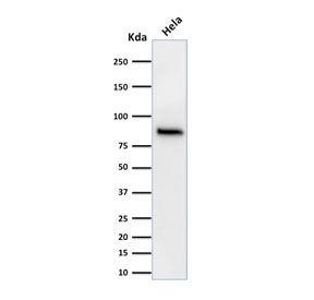 Beta Catenin Antibody Clone 15B8 WB. Western blot testing of human HeLa cell lysate with Beta Catenin antibody (clone 15B8). Predicted molecular weight ~85 kDa, but routinely observed at 90-95 kDa.