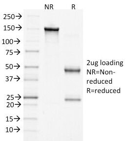 SDS-PAGE Analysis of Purified, BSA-Free Beta Catenin Antibody (clone 15B8). Confirmation of Integrity and Purity of the Antibody.