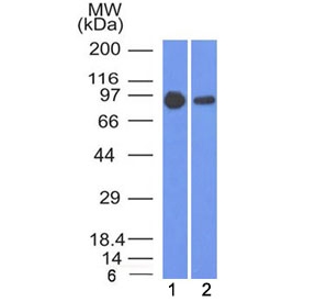 Beta-Catenin Antibody Clone 5H10 WB. Western blot testing of human 1) A431 and 2) A549 cell lysate with Beta Catenin antibody (clone 5H10). Predicted molecular weight ~85 kDa, but routinely observed at 90-95 kDa.
