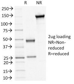 SDS-PAGE Analysis of Purified, BSA-Free DSG3 antibody clone 5H10. Confirmation of Integrity and Purity of the Antibody.