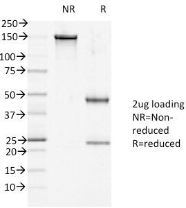 DSG1 Antibody 27B2 Gel Run. SDS-PAGE Analysis of Purified, BSA-Free DSG1 antibody mouse monoclonal clone 27B2. Confirmation of Integrity and Purity of the Antibody.