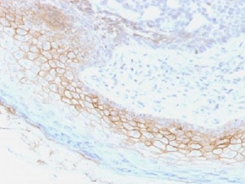 Desmocollin 2/3 Antibody 7G6 FFPE Human Skin Immunohistochemistry. IHC testing of FFPE human skin with Desmocollin 2/3 antibody (clone 7G6). Required HIER: boil tissue sections in 10mM Tris with 1mM EDTA, pH 9, for 10-20 min.