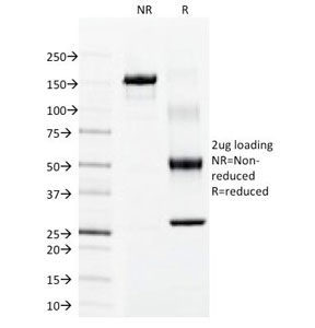 SDS-PAGE Analysis of Purified, BSA-Free Keratin 15 Antibody (clone LHK15). Confirmation of Integrity and Purity of the Antibody.