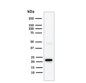 CD3e Antibody Clone C3e/1308. Western blot analysis of CD3 Epsilon / CD3E antibody in human Jurkat cell lysate using CD3e Antibody Clone C3e/1308 / CD3 Epsilon Monoclonal Antibody. Lane 1: human Jurkat cell lysate. A band is detected at approximately 23 kDa, consistent with the predicted molecular weight of CD3 epsilon. The prominent band with low background signal supports specific detection of CD3 epsilon and reliable performance of clone C3e/1308 in western blot analysis.