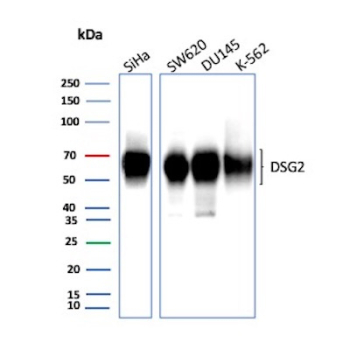Desmoglein-2 Antibody 8E5 Multi-Cell Line WB. Western blot analysis of human SiHa, SW620, DU145, and K-562 cell lysates using Desmoglein-2 antibody detecting DSG2. A band is observed at approximately 55-70 kDa across multiple samples, consistent with a processed or truncated form of Desmoglein 2, while the full-length protein is typically expected at a higher molecular weight depending on glycosylation. Signal is more prominent in epithelial-derived cell lines such as SiHa, SW620, and DU145, consistent with DSG2 expression in cells forming desmosomal adhesion complexes that support intercellular junction integrity, whereas K-562 cells show comparatively reduced signal.