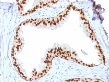IHC testing of FFPE human prostate with FOXA1 antibody (clone FOXA1/1512). HIER: boil sections in 10mM Tris with 1mM EDTA, pH9, for 10-20 min.