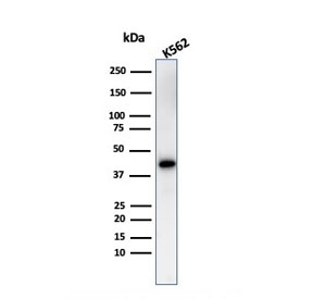Western blot testing of human K562 cell lysate with Glycophorin A antibody. Expected molecular weight: routinely observed at ~16/38 kDa.