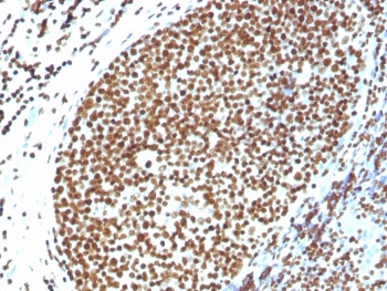 Histone H1 Antibody for IHC. Immunohistochemistry analysis of chromatin differentiation-associated histone H1 expression in FFPE human tonsil tissue using Histone H1 Antibody. Nuclear HRP-DAB brown staining is observed in lymphoid cells, consistent with localization of linker histone H1 within chromatin and its role in dynamic chromatin remodeling during cellular differentiation. The staining highlights strong nuclear compartmentalization with minimal cytoplasmic signal, reflecting chromatin-associated distribution across actively remodeling chromatin states.