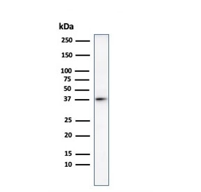 Western blot testing of human heart lysate with Histone H1 antibody. Observed molecular weight ~22/30-33 kDa (unmodified/modified).