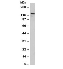 CDH3 Antibody Clone 12H6 A431 Cell WB. Western blot analysis of human A431 cell lysate using CDH3 Antibody Clone 12H6 / Cadherin 3 Monoclonal Antibody. A specific band is detected between approximately 100â130 kDa, consistent with the expected migration range of glycosylated Cadherin 3. The unmodified CDH3 protein has a predicted molecular weight of approximately 91 kDa. These results support the use of CDH3 Antibody Clone 12H6 / Cadherin 3 Monoclonal Antibody for studying Cadherin 3 expression, epithelial adhesion proteins and cell junction regulation.