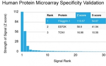 Filaggrin Antibody HuProt Microarray Specificity Validation. Analysis of HuProt(TM) microarray containing more than 19,000 full-length human proteins using Filaggrin antibody (clone FLG/1561). These results demonstrate the foremost specificity of the FLG/1561 mAb. Z- and S- score: The Z-score represents the strength of a signal that an antibody (in combination with a fluorescently-tagged anti-IgG secondary Ab) produces when binding to a particular protein on the HuProt(TM) array. Z-scores are described in units of standard deviations (SD's) above the mean value of all signals generated on that array. If the targets on the HuProt(TM) are arranged in descending order of the Z-score, the S-score is the difference (also in units of SD's) between the Z-scores. The S-score therefore represents the relative target specificity of an Ab to its intended target.