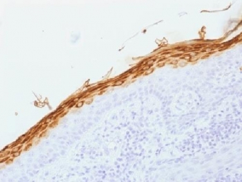 Filaggrin Antibody Stratified Squamous Epithelium IHC. Immunohistochemistry testing of FFPE human skin with Filaggrin antibody (clone FLG/1562). Required HIER: boil tissue sections in 10mM citrate buffer, pH 6, for 10-20 min.