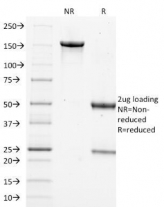SDS-PAGE Analysis of Purified, BSA-Free Filaggrin Antibody (clone FLG/1562). Confirmation of Integrity and Purity of the Antibody.