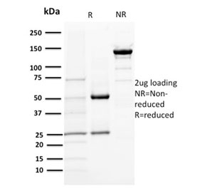 SDS-PAGE analysis of purified, BSA-free DOG 1 antibody (clone DG1/1484) as confirmation of integrity and purity.