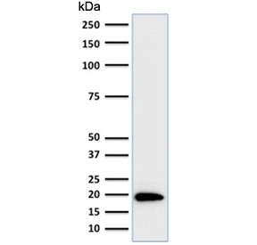 Ferritin Light Chain Antibody HeLa Cell. Western blot testing of human HeLa lysate with Ferritin Light Chain Antibody for Western Blotting (clone FTL/1386). Predicted molecular weight: ~20 kDa.
