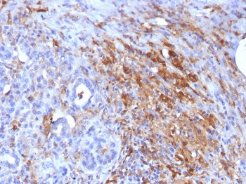 Ferritin Light Chain Antibody Pancreas IHC. Immunohistochemistry staining of FFPE human pancreas with Ferritin Light Chain antibody (clone FTL/1386). HIER: boil tissue sections in pH 9 10mM Tris with 1mM EDTA for 10-20 min and allow to cool before testing.