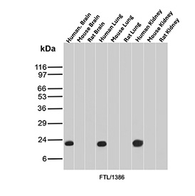 Ferritin Light Chain Antibody for Western Blotting analysis of brain, lung, and kidney tissue lysates. Lane 1: human brain, Lane 2: mouse brain, Lane 3: rat brain, Lane 4: human lung, Lane 5: mouse lung, Lane 6: rat lung, Lane 7: human kidney, Lane 8: mouse kidney, Lane 9: rat kidney. A band is detected at approximately 20 kDa, consistent with the predicted molecular weight of Ferritin Light Chain / FTL. Clone FTL/1386 was used as the detecting antibody, demonstrating ferritin light chain expression across multiple mammalian tissues.