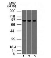 Villin Antibody for WB. Western blot analysis of VIL1 Western Blot Antibody in human epithelial-derived cell lysates using mouse monoclonal clone VIL1/1314. Lane 1: A549 lysate, Lane 2: HepG2 lysate, Lane 3: HCT-116 lysate. A band is detected at approximately 93 kDa, consistent with the predicted molecular weight of Villin-1 / VIL1. The consistent signal across these lysates supports the use of this antibody for western blot detection of brush border-associated Villin protein in epithelial biology studies.