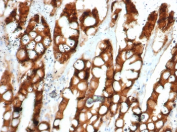 EpCAM Antibody Cat Small Intestine Tissue IHC. Immunohistochemistry testing of FFPE cat small intestine and EpCAM antibody (clone EGP40/1384). HIER: steam sections in pH9 EDTA for 10-20 min.