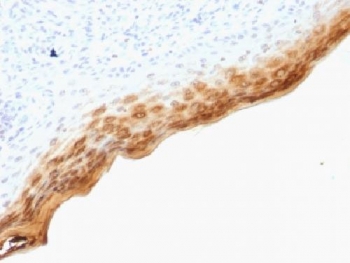 Filaggrin Antibody SPM181 Human Skin IHC. Immunohistochemistry testing of FFPE human skin with Filaggrin antibody (clone SPM181). Required HIER: boil tissue sections in pH 9 10mM Tris with 1mM EDTA for 10-20 min.