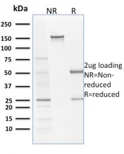 SDS-PAGE analysis of purified, BSA-free Filaggrin antibody clone SPM181 as confirmation of integrity and purity.
