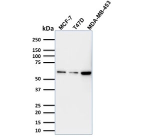p63 Antibody for WB. Western blot analysis of human MCF-7, T-47D, and MDA-MB-453 cell lysates using mouse monoclonal clone TP63/1786 demonstrates detection of Tumor protein 63 (TP63) as a band at the predicted molecular weight of approximately 63-77 kDa. Signal intensity varies across the cell lines, with stronger expression observed in MDA-MB-453 cells and comparatively lower levels in MCF-7 and T-47D, consistent with differences in TP63 expression associated with epithelial subtype characteristics. The clean banding pattern with minimal background supports the specificity of clone TP63/1786, aligning with its microarray-validated target recognition and suitability for western blot detection of TP63 isoforms.