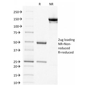 SDS-PAGE analysis of purified, BSA-free p63 antibody (clone TP63/1786) as confirmation of integrity and purity.