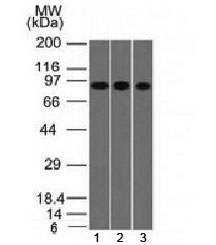 Villin Antibody for WB. Western blot analysis of Villin-1 (VIL1) using Villin Antibody / Epithelial Tumor Marker Antibody with mouse monoclonal clone VIL1/1325 in human epithelial-derived cell lysates. Lane 1: A549 lysate, Lane 2: HepG2 lysate, Lane 3: HCT-116 lysate. A band is detected at approximately 93 kDa, consistent with the predicted molecular weight of Villin-1 / VIL1. The consistent detection across carcinoma cell lines supports use of Villin as an epithelial tumor marker for assessing protein expression in cancer-derived samples and evaluating epithelial lineage in tumor cell lysates.