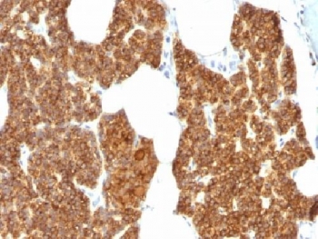 PTH Antibody Rabbit Polyclonal immunohistochemistry of human parathyroid gland. FFPE human parathyroid gland stained using PTH Antibody Rabbit Polyclonal. Strong cytoplasmic brown chromogenic staining is observed in parathyroid endocrine chief cells, consistent with the expected intracellular localization of Parathyroid hormone (PTH) in hormone-producing cells of the parathyroid gland. Immunohistochemistry staining was performed following heat-induced epitope retrieval using steam treatment in 10mM citrate buffer (pH 6.0) for 10-20 minutes.