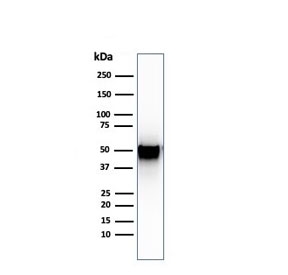 Thymidine Phosphorylase Antibody Human Spleen WB. Western blot testing of human spleen lysate with Thymidine Phosphorylase antibody (clone SPM322). Predicted molecular weight ~55 kDa.