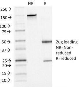 P-Cadherin Antibody Clone 6A9 Purity Gel Run. SDS-PAGE analysis of purified, BSA-free P-Cadherin Antibody Clone 6A9 / Mouse Monoclonal Antibody under non-reducing (NR) and reducing (R) conditions. A 2 ug sample was analyzed to confirm antibody integrity and purity. The non-reduced antibody migrates at approximately 150 kDa, while reduced conditions show expected heavy and light chain bands near 50 kDa and 25 kDa, respectively. These results demonstrate the purity of P-Cadherin Antibody Clone 6A9 / Mouse Monoclonal Antibody and support its use in antibody-based detection applications.