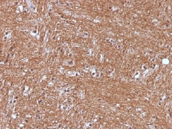 NSE Antibody human cerebellum IHC staining. Immunohistochemistry analysis of Neuron Specific Enolase in FFPE human cerebellum using NSE Antibody / Neuronal Differentiation Marker Antibody clone ENO2/1375 demonstrates strong cytoplasmic HRP-DAB brown staining in neuronal cell populations, consistent with neuronal differentiation and high ENO2 expression in cerebellar tissue, while non-neuronal regions show comparatively lower staining. The staining pattern highlights neuronal morphology and dense cellular architecture within the cerebellum. Heat-induced epitope retrieval was performed using pH 9 Tris-EDTA buffer for 10-20 min prior to staining.