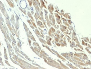 NSE Antibody Rat Heart IHC. Immunohistochemistry testing of FFPE rat heart with NSE antibody (clone ENO2/1375). Required HIER: boil sections in pH 9 10mM Tris with 1mM EDTA for 10-20 min.