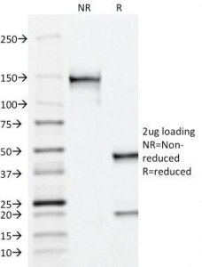 SDS-PAGE Analysis of Purified, BSA-Free Prostate Acid Phosphatase Antibody (ACPP/1338). Confirmation of Integrity and Purity of the Antibody.