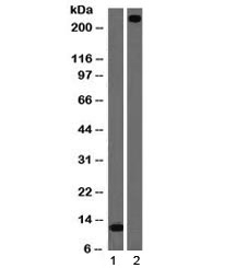 vWF Antibody Clone VWF/1465 western blot analysis. Western blot of 1) partial recombinant protein and 2) human lung lysate using vWF Antibody Clone VWF/1465 (clone VWF/1465). Lane 1 shows a lower molecular weight band corresponding to a truncated recombinant fragment, while lane 2 shows a prominent band at approximately 250 kDa, consistent with the predicted molecular weight of von Willebrand factor (VWF). The higher molecular weight signal in lung lysate is consistent with the heavily glycosylated nature of VWF, which undergoes extensive post-translational modification and multimerization, often producing an elevated or broadened apparent molecular weight on SDS-PAGE relative to the core protein.