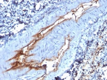 vWF Antibody / Endothelial Injury Response Marker Antibody. Immunohistochemistry analysis of human spleen tissue shows HRP-DAB brown staining of endothelial cells lining vascular channels, with prominent signal along vessel surfaces and adjacent regions. The staining pattern highlights endothelial-associated signal consistent with activation or injury response, with irregular and intensified deposition along portions of the vascular lining. Vessel structures are clearly distinguished from surrounding splenic tissue, allowing visualization of endothelial response within the vascular compartment. Clone VWF/1767 enables detection of endothelial-associated signal linked to vascular response and injury-related changes. Required HIER: boil tissue sections in 10mM citrate buffer, pH 6, for 10-20 min followed by cooling at RT for 20 min.