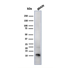 Western blot testing of human brain tissue lysate with S100B antibody. Predicted molecular weight ~11 kDa.