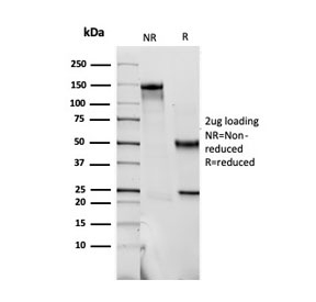 SDS-PAGE analysis of purified, BSA-free S100B antibody (clone SPM354) as confirmation of integrity and purity.