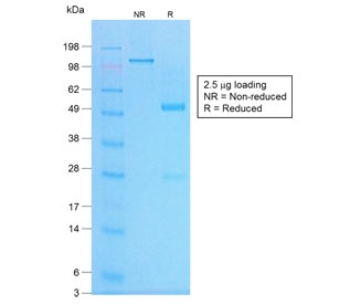 SDS-PAGE analysis of purified, BSA-free recombinant Chromogranin A antibody (clone CHGA/1773R) as confirmation of integrity and purity.