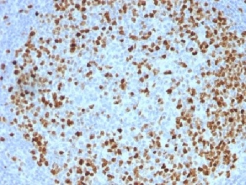 TOP2A Antibody Tonsil IHC. Immunohistochemistry analysis of FFPE human tonsil tissue demonstrates strong nuclear staining consistent with expression of the chromosome segregation enzyme DNA Topoisomerase II alpha in proliferating lymphoid cells. Nuclear immunoreactivity is concentrated within germinal center lymphocytes, reflecting the high mitotic activity of these cells during immune responses. The Chromosome Segregation Enzyme Antibody highlights proliferating germinal center B cells where mitotic chromosome segregation and chromatid decatenation are actively occurring, while surrounding mantle zone lymphocytes show minimal staining. Required HIER: boil tissue sections in pH 9 Tris-EDTA buffer for 10-20 min followed by cooling at RT for 20 min prior to immunohistochemistry staining.