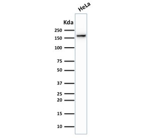 TOP2A Antibody HeLa WB. Western blot analysis of human HeLa cell lysate following SDS-PAGE separation and membrane transfer demonstrates detection of DNA Topoisomerase II alpha. A band is detected at approximately 170-180 kDa, consistent with the predicted molecular weight of DNA Topoisomerase II alpha / TOP2A (~174 kDa). The signal corresponds to the chromosome segregation enzyme responsible for resolving DNA catenanes and enabling sister chromatid separation during mitosis. Detection of the denatured TOP2A protein band confirms the utility of this Chromosome Segregation Enzyme Antibody for western blot analysis of this essential mitotic enzyme in human cell lysates.