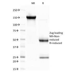 SDS-PAGE Analysis of Purified, BSA-Free CELA3B Antibody (clone CELA3B/1757). Confirmation of Integrity and Purity of the Antibody.