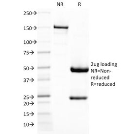 SDS-PAGE Analysis of Purified, BSA-Free DC-SIGN Antibody (clone C209/1781). Confirmation of Integrity and Purity of the Antibody.