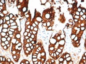 IHC testing of FFPE cat small intestine and Ep-CAM antibody (clone EGP40/1798). Required HIER: steam sections in pH6 citrate buffer for 10-20 min.