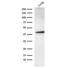 Western blot testing of human lung lysate with recombinant EpCAM antibody (clone rMOC-31).