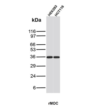 EpCAM Antibody HEK293 & HCT116 WB. Western blot analysis of HEK293 and HCT116 cell lysates using EpCAM Antibody (clone rMOC-31) demonstrates a strong immunoreactive band at approximately 36-40 kDa in both cell lines. The observed molecular weight is consistent with Epithelial Cell Adhesion Molecule (EpCAM/CD326), a heavily glycosylated transmembrane glycoprotein involved in epithelial cell adhesion, tissue organization, and cellular signaling. The slight increase in apparent molecular weight relative to the predicted protein size is consistent with known glycosylation of EpCAM. Detection in both HEK293 and HCT116 cells is consistent with the established expression of EpCAM in epithelial-derived cell populations and supports the specificity of the antibody for recognition of EpCAM protein.