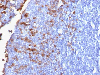 Human IgG Antibody IG1707R Human Tonsil IHC. Immunohistochemistry was performed on FFPE human tonsil tissue using Human IgG Antibody IG1707R. Heat-induced epitope retrieval was performed by boiling tissue sections in 10 mM citrate buffer (pH 6) for 10â20 minutes followed by cooling at room temperature for 20 minutes prior to staining. Strong cytoplasmic staining is observed in scattered plasma cells within the tonsillar lymphoid tissue, while the surrounding lymphocytes exhibit minimal background staining. This staining pattern is consistent with the expected expression of human IgG in antibody-producing plasma cells. These results demonstrate that Human IgG Antibody IG1707R is suitable for immunohistochemical detection of human IgG in formalin-fixed, paraffin-embedded human tissues.
