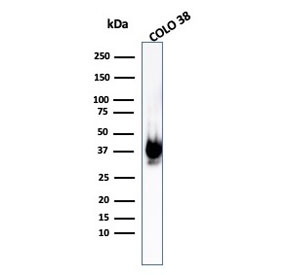 Western blot testing of human COLO-38 cell lysate with recombinant gp100 antibody (clone PMEL/1825R). The ~100 kDa glycosylated PMEL precursor is proteolytically cleaved into an ~60-64 kDa M-alpha fragment and an ~26 kDa M-beta fragment. The M-alpha fragment is subsequently processed into ~34-38 kDa and ~26 kDa fragments that assemble into the fibrillar matrix of melanosomes.