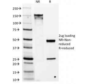SDS-PAGE analysis of purified, BSA-free DOG 1 antibody (clone DG1/1486) as confirmation of integrity and purity.